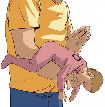 Извлечение инородного тела у младенца
